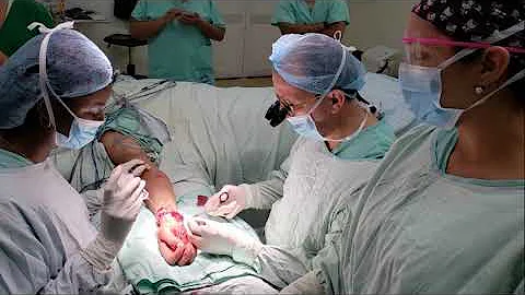 ¿Cuánto dura una operación de manos?