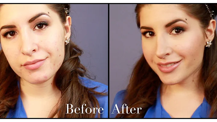 How to Cover Acne | MissJessicaHarlo...