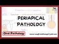 Periapical cyst - symptoms, diagnosis, differential diagnosis, treatment, theories of cyst formation