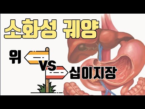 소화성궤양의 원인ㆍ증상ㆍ진단ㆍ합병증 그리고 감별진단까지 ...