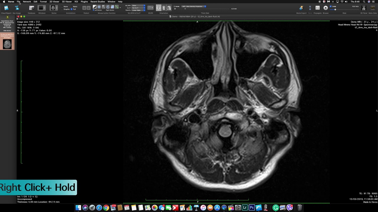 horos dicom viewer download horos dicom viewer download