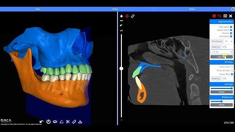 CephX AI DICOM Viewer