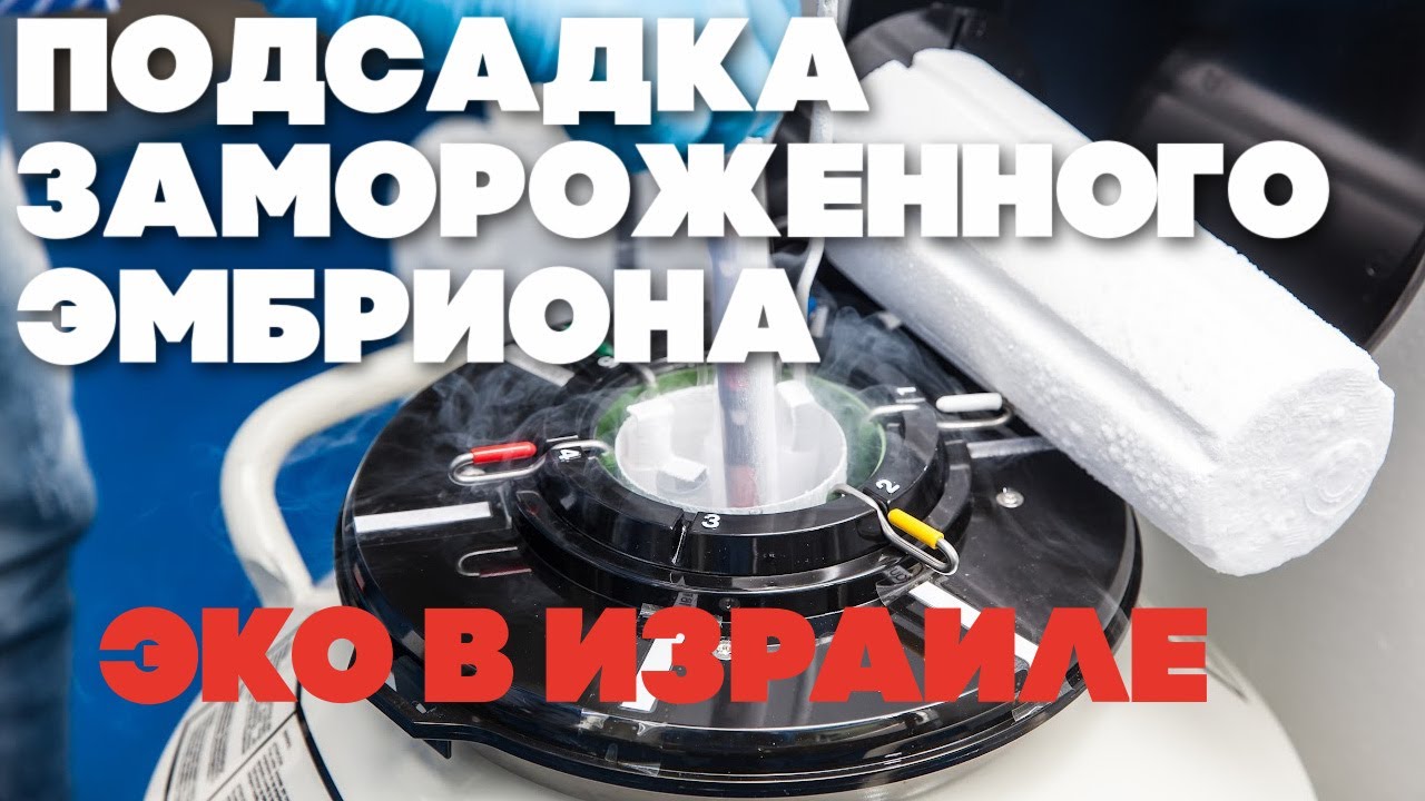 криоконсервация 2 эмбрионов. экстракорпоральное оплодотворен. перенос эмбриона в матку эко. перенос в естественном цикле криоконсервированных эмбрионов. подсадка замороженных эмбрионов.