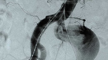 The Low-Dose Enabler: imagiQ2 and imagiQ3 Legacy, surgical imaging tables