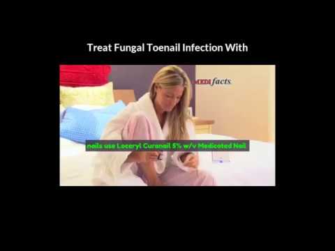 Loceryl Curanail 5 Wv Medicated Nail Lacquer Fungus