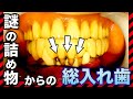 謎の詰め物からの総入れ歯💦Full dentures from mysterious stuffing