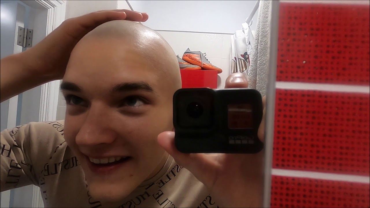 Es ist passiert.. Ich hab 'ne GLATZE...