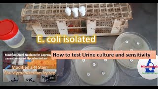 How to test urine culture and sensitivity