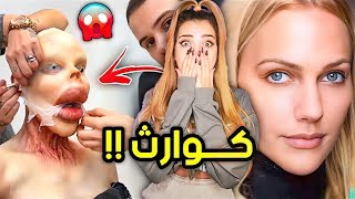 تجميعية اشخاص جابو العيد بأنفسهم !ابشع عمليات تجميل في العالم