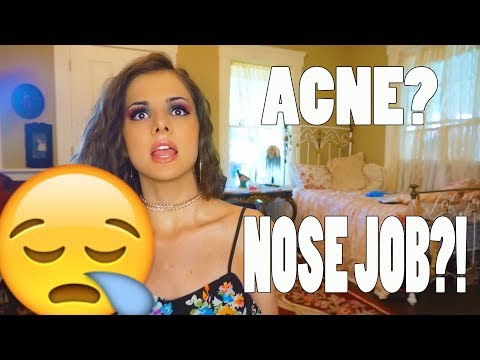 ACNE AND NOSE JOB?! | Storytime |