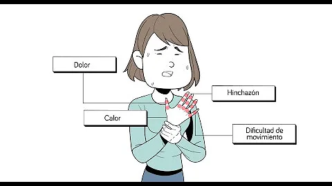 ¿Cómo se sabe si se padece artritis psoriásica?