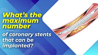 What’s the maximum number of coronary stents that can be implanted?