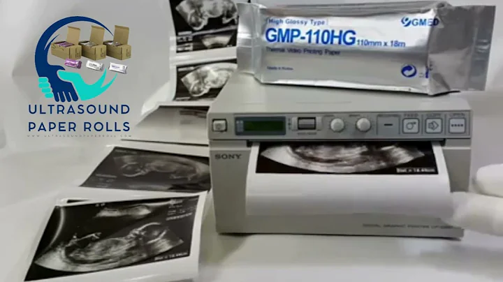 "How to Clean Printer Head for Ultrasound Thermal Video Printer | Ultrasound Paper Roll PVT LTD"