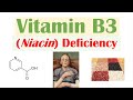 Vitamin B3 Niacin Deficiency (Pellagra) | Sources, Causes, Symptoms, Diagnosis, Treatment