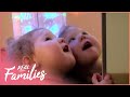 19-Month-Old Has Surgery To Reshape Her Skull | Children's Hospital | Real Families
