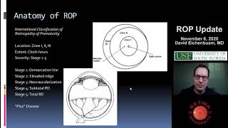 Retinopathy of Prematurity Update - David Eichenbaum, MD