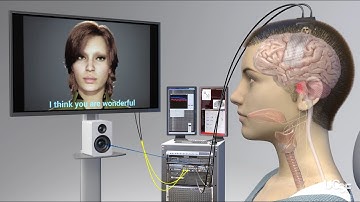 BCI Award 2023 Nomination -A high-performance neuroprosthesis for speech decoding and avatar control