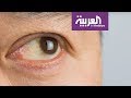 عادات يومية تهدد صحة العين