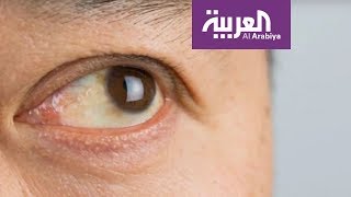 عادات يومية تهدد صحة العين