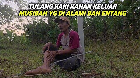 KAGET..CERITA PAHIT BAH ENTANG TERJATOH DARI POHON SAMPAI TULANG KAKI KANAN KELUAR MARI KITA BANTU !