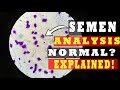 What is Semen Analysis Test | Procedure, Normal &amp; Abnormal Report [EXPLAINED!]