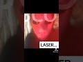 Laser