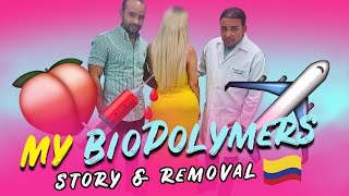 MY BIOPOLYMERS STORY/REMOVAL DR. JOAQUIN CUELLO| CALI,COLOMBIA