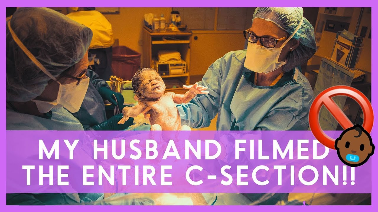 GENTLE C SECTION BIRTH VIDEO (w/ Cholestasis During Pregnancy) Sippers' Birth Stories (Part 3