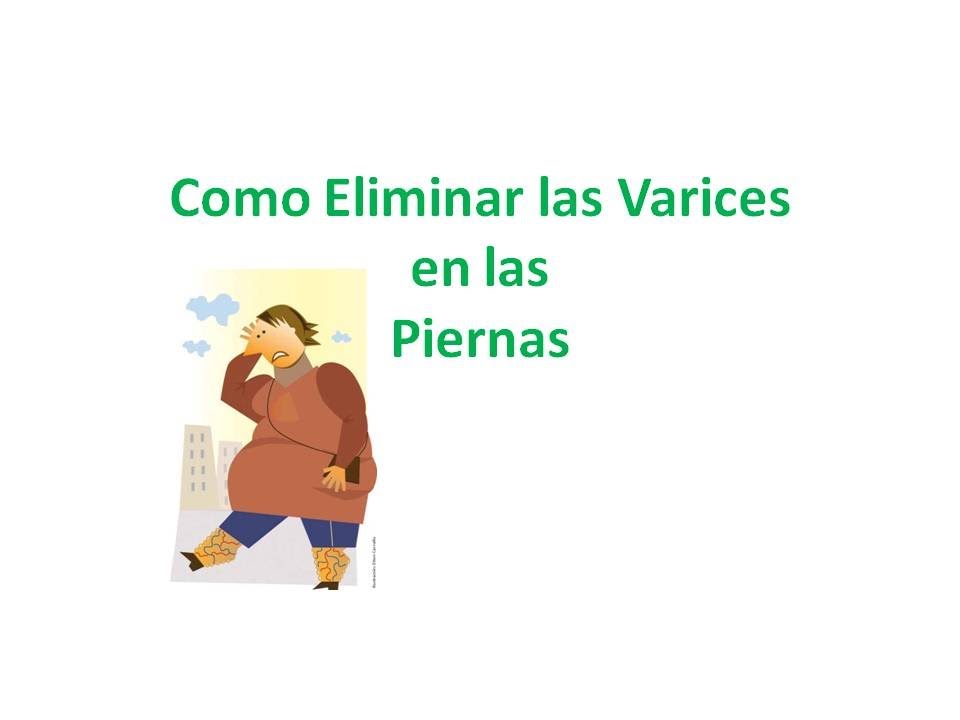 venas varices tratamiento casero Como Quitar Las Varices De Las Piernas-Remedios
