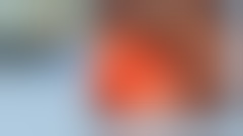 Full thickness resection submucosal tumor colon