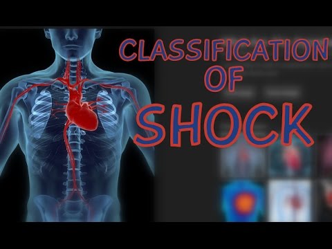 septic shock vs cardiogenic shock Septic shock signs of shock may not become evident until a 50% lossof blood volume in the treatment of cardiogenic shock depends on its mechanism. septic shock vs cardiogenic shock Septic shock signs of shock may not become evident until a 50% lossof blood volume in the treatment of cardiogenic shock depends on its mechanism.