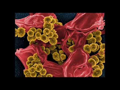 Video: Hämolytischer Staphylococcus Aureus - Symptome, Infektionswege Und Behandlung