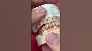 It is important use the tissue and clasps colors!