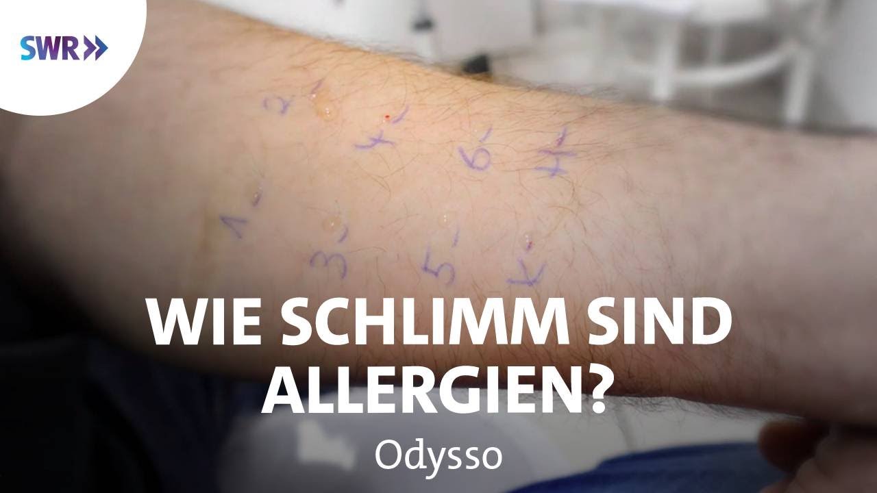 Erste Hilfe bei Allergien | SWR Wissen