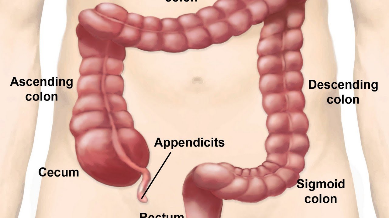 Аппендицит расположен. Расположение аппендицита у человека. Где находится аппендикс у человека.