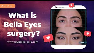 What is Bella Eyes surgery?