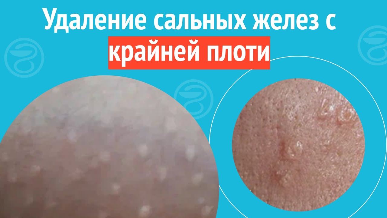 Стекающая смазка с красной головки хера фото