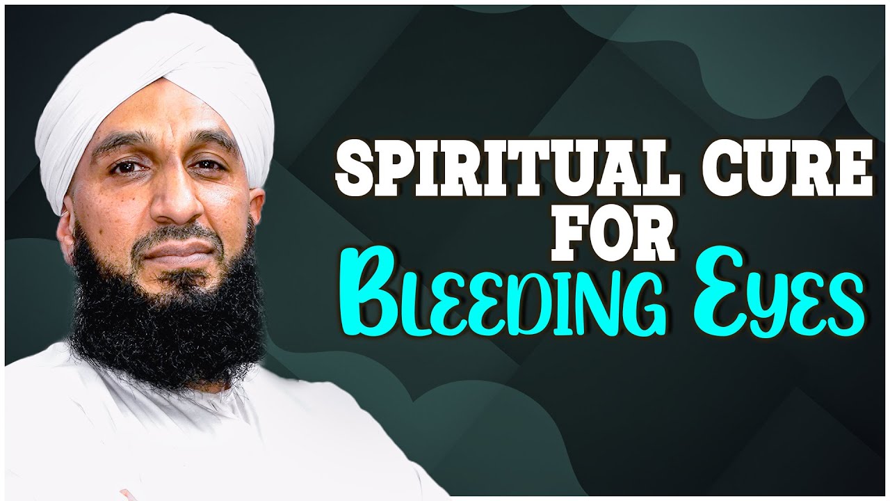 Spiritual Cure for Bleeding Eyes Tasawwur Madani Madani Channel English YouTube