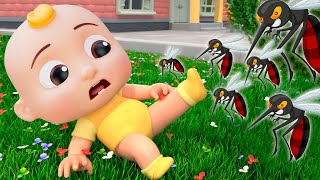 Ouchie Ouch Song The Boo Boo Song Cocomelon Toys Nursery Rhymes & Kids Songs