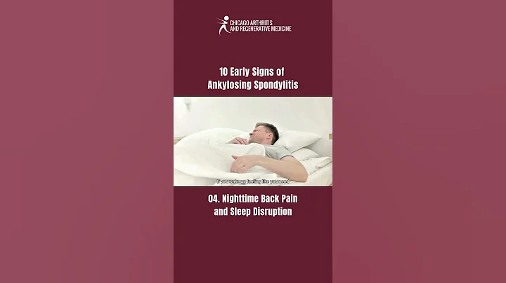 10 Early Signs of Ankylosing Spondylitis You Shouldn’t Ignore!