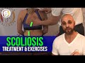 Best Scoliosis Exercises | Scoliosis treatment