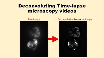 Mitochondrial Dynamics-Part 2 (Enhancing Time-lapse Video via Deconvolution)