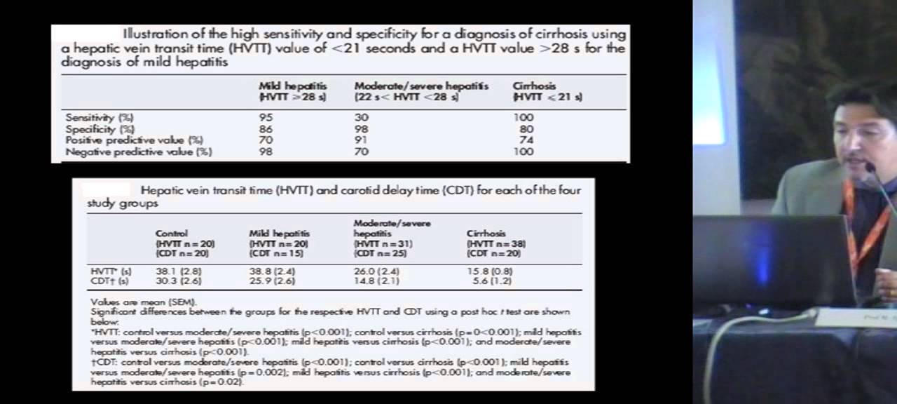 Diagnosi ecografica di Cirrosi Epatica  sensibilità, specificità e impatto clinico -- R  Chiavaroli