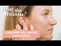 I Learned How To Apply Ear Seeds + Their Benefits | What the Wellness | Well+Good