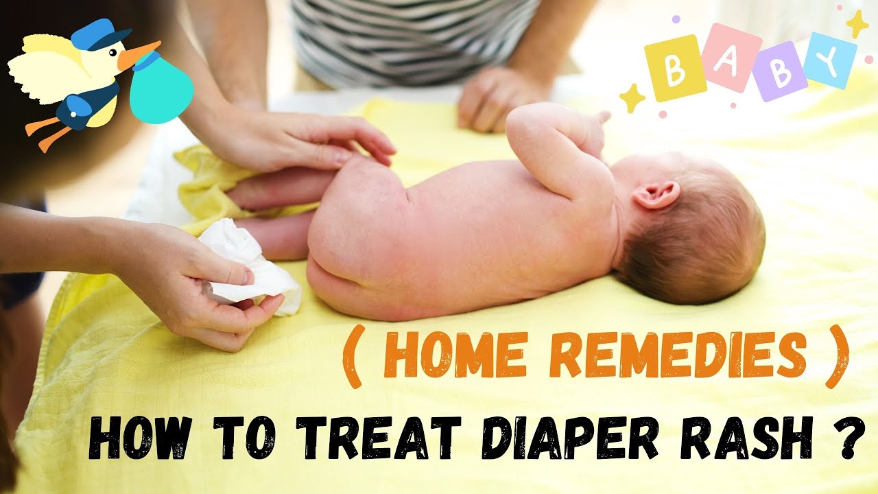 How to treat nappy rash with home remedies NappyRash diaper rash