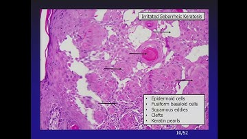 Oakstone pathology DEMO