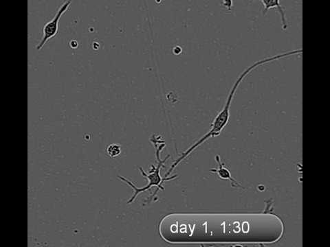 Cell Motility of Microglia Cultured in TIC