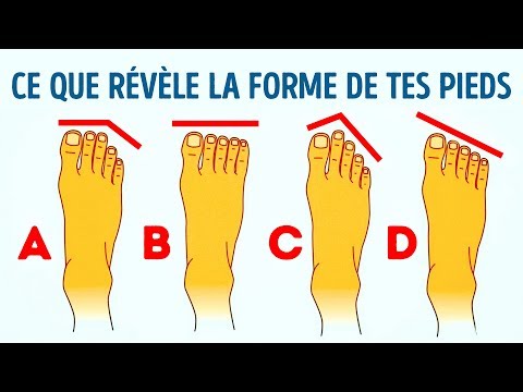 Vidéo: Ce Que L'orteil De Morton Signifie Pour Vos Pieds