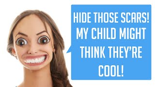 HIDE THOSE SCARS! MY CHILD MIGHT THINK THEY'RE COOL! - r/Entitledparents - Best Story Reading