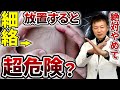 【放置厳禁】血管が詰まるサイン|細絡の本当の話をお伝えします(血行不良、リンパ、下肢静脈瘤、浮腫み)